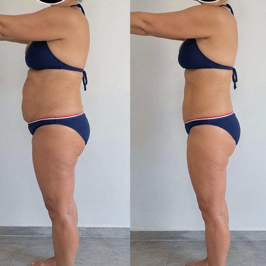 Transformation avant/après 1