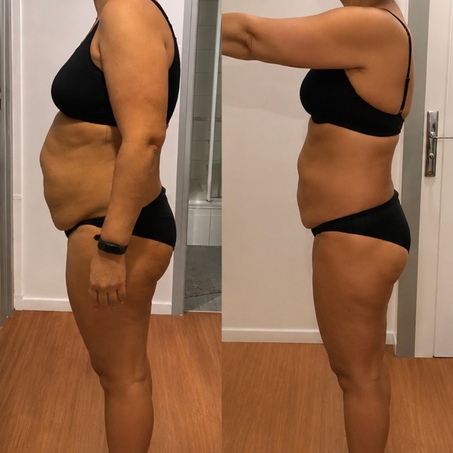 Transformation avant/après 4